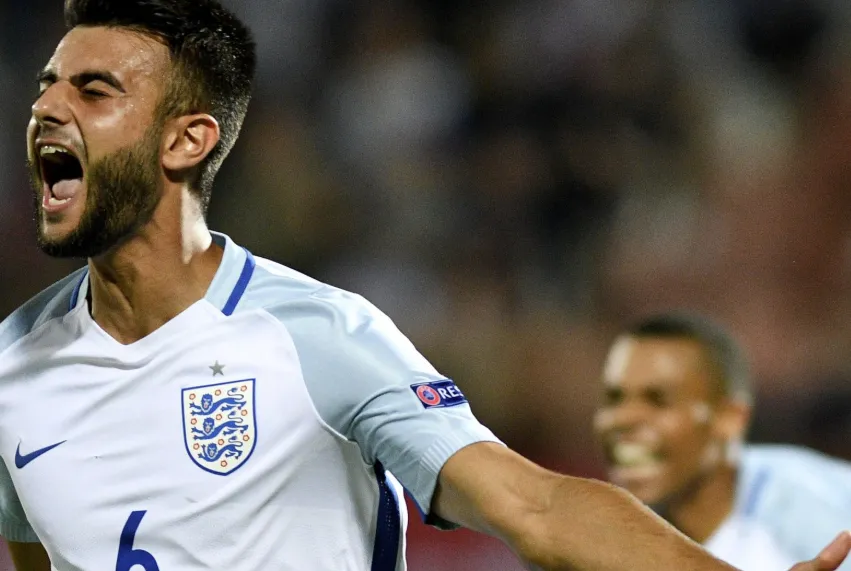 The Stark Reality of Under-Representation